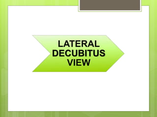 LATERAL
DECUBITUS
VIEW
 
