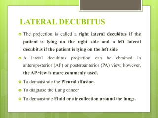 LATERAL DECUBITUS
 The projection is called a right lateral decubitus if the
patient is lying on the right side and a left lateral
decubitus if the patient is lying on the left side.
 A lateral decubitus projection can be obtained in
anteroposterior (AP) or posteroanterior (PA) view; however,
the AP view is more commonly used.
 To demonstrate the Pleural effusion.
 To diagnose the Lung cancer
 To demonstrate Fluid or air collection around the lungs.
 