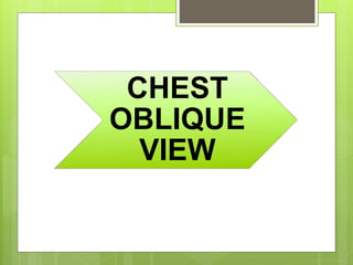CHEST
OBLIQUE
VIEW
 