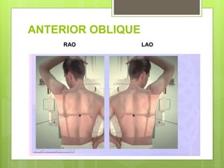 ANTERIOR OBLIQUE
RAO LAO
 