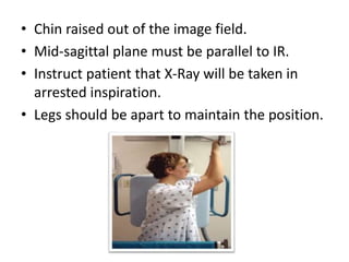 • Chin raised out of the image field.
• Mid-sagittal plane must be parallel to IR.
• Instruct patient that X-Ray will be taken in
arrested inspiration.
• Legs should be apart to maintain the position.
 