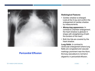 Basics of Chest X Ray Reading | PDF