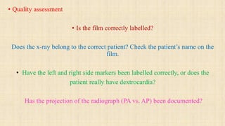 Chest radiology | PDF