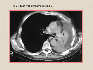 A CT scan was done shown below
 