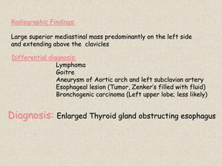 Diagnosis: Enlarged Thyroid gland obstructing esophagus
Radiographic Findings:
Large superior mediastinal mass predominantly on the left side
and extending above the clavicles
Differential diagnosis:
Lymphoma
Goitre
Aneurysm of Aortic arch and left subclavian artery
Esophageal lesion (Tumor, Zenker’s filled with fluid)
Bronchogenic carcinoma (Left upper lobe; less likely)
 