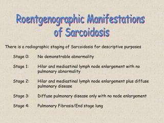 There is a radiographic staging of Sarcoidosis for descriptive purposes
Stage 0: No demonstrable abnormality
Stage 1: Hilar and mediastinal lymph node enlargement with no
pulmonary abnormality
Stage 2: Hilar and mediastinal lymph node enlargement plus diffuse
pulmonary disease
Stage 3: Diffuse pulmonary disease only with no node enlargement
Stage 4: Pulmonary Fibrosis/End stage lung
 