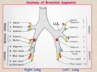 Anatomy of Bronchial Segments
LUL
Right Lung Left. Lung
 