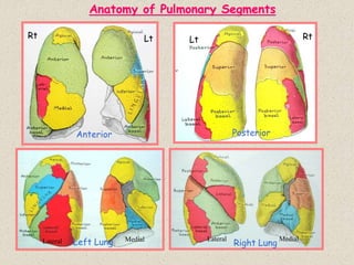 Rt Lt
Anterior
Lateral Medial
Left Lung Lateral Medial
Right Lung
Posterior
Anatomy of Pulmonary Segments
Lt Rt
 