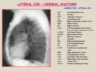 LATERAL CXR - NORMAL ANATOMY
LIV Left innominate vein
TR Trachea
SVC Superior venacava
AA Ascending Aorta
RVO Right ventricular outflow tract
MiF Minor fissure
RV Right ventricle
LLH Left lung against heart border
(bare area of heart & mediastinum on left side)
L Ma F Left major fissure
R Ma F Right major fissure
IVC Inferior venacava
St Stomach
RD Right hemidiaphragm
LD Left hemidiaphragm
LV left ventricle
Co PV Confluence of pulmonary
veins
RPA Right pulmonary artery
LPA Left pulmonary artery
l u b Left upper lobe bronchus
r u b Right upper lobe bronchus
Ao A Aortic arch
T-E St Tracheo-esophageal stripe
LEGEND FOR LATERAL CXR
rub
lub
T-E St
 