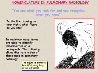 NOMENCLATURE IN PULMONARY RADIOLOGY
“You see what you look for and you recognise
what you know”
In the line drawing on
your right, what figure
do you see?
In radiology many terms
are used to identify
abnormalities on a
radiograph. The following
slides illustrate a few of
these used in pulmonary
radiology
The figure is either a
beautiful young lady
or an old woman
 