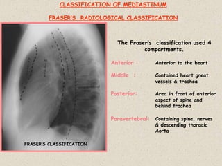 FRASER’S CLASSIFICATION
The Fraser’s classification used 4
compartments.
Anterior : Anterior to the heart
Middle : Contained heart great
vessels & trachea
Posterior: Area in front of anterior
aspect of spine and
behind trachea
Paravertebral: Containing spine, nerves
& descending thoracic
Aorta
CLASSIFICATION OF MEDIASTINUM
FRASER’S RADIOLOGICAL CLASSIFICATION
 