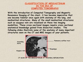 CLASSIFICATION OF MEDIASTINUM
IN THE ERA OF
COMPUTED TOMOGRAPHY
With the introduction of Computed Tomography and Magnetic
Resonance Imaging of the chest, it has become imperative that
one become familiar once again with anatomy of the lung, and
mediastinal structures. Many of the small mediastinal structures
such as azygous vein are visualized on these two imaging
modalities. These cross-sectional images require cross-sectional
anatomical knowledge gained from dissection studies. The
following slides illustrate some of the anatomy of many important
structures seen on the CT and MRI images of your patients.
Esopahgus
Azygous vein
Ascending
Aorta
Pulmonary outflow tract
CT SCAN OF THE MEDIASTINUM AT TRACHEAL BIFURCATION
 