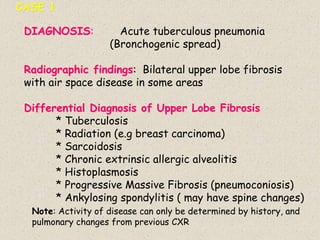 DIAGNOSIS: Acute tuberculous pneumonia
(Bronchogenic spread)
Radiographic findings: Bilateral upper lobe fibrosis
with air space disease in some areas
Differential Diagnosis of Upper Lobe Fibrosis
* Tuberculosis
* Radiation (e.g breast carcinoma)
* Sarcoidosis
* Chronic extrinsic allergic alveolitis
* Histoplasmosis
* Progressive Massive Fibrosis (pneumoconiosis)
* Ankylosing spondylitis ( may have spine changes)
Note: Activity of disease can only be determined by history, and
pulmonary changes from previous CXR
CASE 1
 