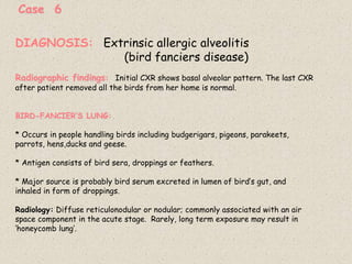 Case 6
Radiographic findings: Initial CXR shows basal alveolar pattern. The last CXR
after patient removed all the birds from her home is normal.
BIRD-FANCIER’S LUNG:
* Occurs in people handling birds including budgerigars, pigeons, parakeets,
parrots, hens,ducks and geese.
* Antigen consists of bird sera, droppings or feathers.
* Major source is probably bird serum excreted in lumen of bird’s gut, and
inhaled in form of droppings.
Radiology: Diffuse reticulonodular or nodular; commonly associated with an air
space component in the acute stage. Rarely, long term exposure may result in
‘honeycomb lung’.
DIAGNOSIS: Extrinsic allergic alveolitis
(bird fanciers disease)
 