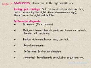 Case 7 DIAGNOSIS: Hamartoma in the right middle lobe
Radiographic findings: Soft tissue density nodule overlying
but not obscuring the right hilum (hilum overlay sign),
therefore in the right middle lobe.
Differential diagnosis:
 Granuloma (Tuberculoma)
 Malignant tumor: Bronchogenic carcinoma, metastasis,
alveolar cell carcinoma,
 Benign: Adenoma, hamartoma, carcinoid
 Round pneumonia
 Infections: Echinococcal nodule
 Congenital: Bronchogenic cyst, Lobar sequestration.
(See next slide for discussion)
 