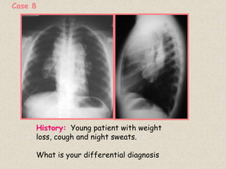 Case 8
History: Young patient with weight
loss, cough and night sweats.
What is your differential diagnosis
 