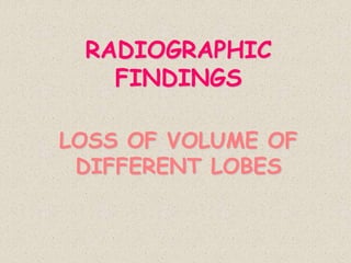 RADIOGRAPHIC
FINDINGS
LOSS OF VOLUME OF
DIFFERENT LOBES
 