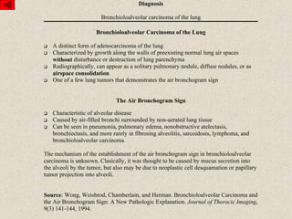Diagnosis
Bronchioloalveolar carcinoma of the lung
Bronchioloalveolar Carcinoma of the Lung
 A distinct form of adenocarcinoma of the lung
 Characterized by growth along the walls of preexisting normal lung air spaces
without disturbance or destruction of lung parenchyma
 Radiographically, can appear as a solitary pulmonary nodule, diffuse nodules, or as
airspace consolidation
 One of a few lung tumors that demonstrates the air bronchogram sign
The Air Bronchogram Sign
 Characteristic of alveolar disease
 Caused by air-filled bronchi surrounded by non-aerated lung tissue
 Can be seen in pneumonia, pulmonary edema, nonobstructive atelectasis,
bronchiectasis, and more rarely in fibrosing alveolitis, sarcoidosis, lymphoma, and
bronchioloalveolar carcinoma.
The mechanism of the establishment of the air bronchogram sign in bronchioloalveolar
carcinoma is unknown. Clasically, it was thought to be caused by mucus secretion into
the alveoli by the tumor, but also may be due to neoplastic cell desquamation or papillary
tumor projection into alveoli.
Source: Wong, Weisbrod, Chamberlain, and Herman. Bronchioloalveolar Carcinoma and
the Air Bronchogram Sign: A New Pathologic Explanation. Journal of Thoracic Imaging,
9(3) 141-144, 1994.
 