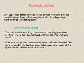 Radiologic Findings
Left upper lobe consolidation as well as diffuse right lung airspace
consolidation with multiple areas of cavitation, including a large
right lower lobe cavitating lesion.
Further Diagnostic Workup
The patient underwent lung biopsy, where caseating granulomas
positive for acid-fast bacilli (Mycobacterium Tuberculosis) were
found.
Note that this patient complained of lower back pain. No spinal films
were included in this teaching case. Tuberculous involvement of the
spinal tissues is known as Pott’s disease.
 