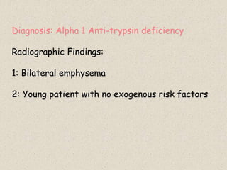 Diagnosis: Alpha 1 Anti-trypsin deficiency
Radiographic Findings:
1: Bilateral emphysema
2: Young patient with no exogenous risk factors
 