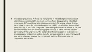CHEST RADIOLOGY (Respiratory System).pptx