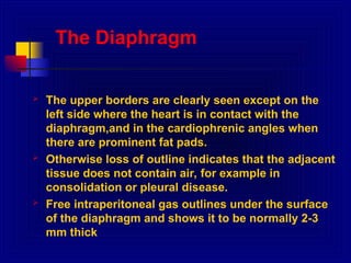 chest radiology details of interptetation .ppt