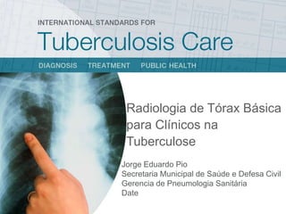 Radiologia de Tórax Básica
para Clínicos na
Tuberculose
Jorge Eduardo Pio
Secretaria Municipal de Saúde e Defesa Civil
Gerencia de Pneumologia Sanitária
Date
 