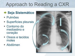 Approach to Reading a CXR
 Seja Sistemático
 Pulmões
 Superficies pleurais
 Contorno do
mediastino e
coração
 Ossos e tecidos
moles
 Abdômen
 