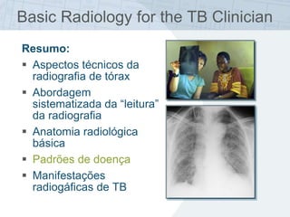 Basic Radiology for the TB Clinician
Resumo:
 Aspectos técnicos da
radiografia de tórax
 Abordagem
sistematizada da “leitura”
da radiografia
 Anatomia radiológica
básica
 Padrões de doença
 Manifestações
radiogáficas de TB
 