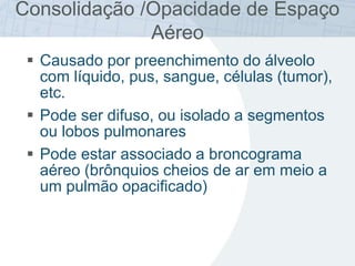  Causado por preenchimento do álveolo
com líquido, pus, sangue, células (tumor),
etc.
 Pode ser difuso, ou isolado a segmentos
ou lobos pulmonares
 Pode estar associado a broncograma
aéreo (brônquios cheios de ar em meio a
um pulmão opacificado)
Consolidação /Opacidade de Espaço
Aéreo
 