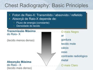 Chest Radiography: Basic Principles
O mais Negro
ar
gordura
tecido mole
cálcio
osso
contraste radiológico
metal
O mais Claro
Transmissão Máxima
do Raio- X
(tecido menos denso)
Absorção Máxima
do Raio - X
(tecido mais denso)
 Foton de Raio-X: Transmitido / absorvido / refletido
 Absorçã de Raio-X depende de:
• Fluxo de energia (constante)
• Densidade do tecido
 