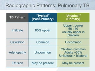 TB Pattern
“Typical”
(Post-Primary)
“Atypical”
(Primary)
Infiltrate 85% upper
Upper : Lower
60 : 40
Usually upper in
children
Cavitation Common Uncommon
Adenopathy Uncommon
Children common
Adults ~30%
Unilateral > bilateral
Effusion May be present May be present
Radiographic Patterns: Pulmonary TB
 