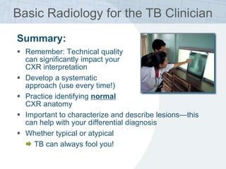 Basic Radiology for the TB Clinician
Summary:
 Remember: Technical quality
can significantly impact your
CXR interpretation
 Develop a systematic
approach (use every time!)
 Practice identifying normal
CXR anatomy
 Important to characterize and describe lesions—this
can help with your differential diagnosis
 Whether typical or atypical
 TB can always fool you!
 