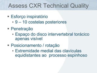 Assess CXR Technical Quality
 Esforço inspiratório
• 9 – 10 costelas posteriores
 Penetração
• Espaço do disco intervertebral torácico
apenas visível
 Posicionamento / rotação
• Extremidade medial das clavículas
equidistantes ao processo espinhoso
 