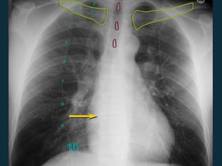 10
1
2
3
4
5
6
7
8
9
 