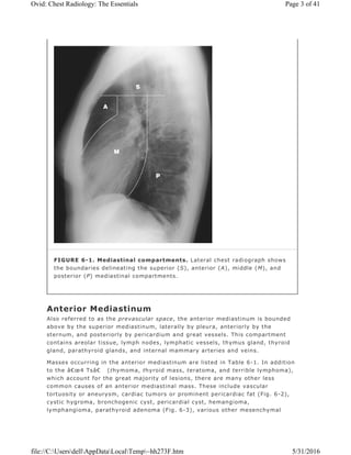 Anterior Mediastinum
Also referred to as the prevascular space, the anterior mediastinum is bounded
above by the superior mediastinum, laterally by pleura, anteriorly by the
sternum, and posteriorly by pericardium and great vessels. This compartment
contains areolar tissue, lymph nodes, lymphatic vessels, thymus gland, thyroid
gland, parathyroid glands, and internal mammary arteries and veins.
Masses occurring in the anterior mediastinum are listed in Table 6-1. In addition
to the â€œ4 Tsâ€ (thymoma, thyroid mass, teratoma, and terrible lymphoma),
which account for the great majority of lesions, there are many other less
common causes of an anterior mediastinal mass. These include vascular
tortuosity or aneurysm, cardiac tumors or prominent pericardiac fat (Fig. 6-2),
cystic hygroma, bronchogenic cyst, pericardial cyst, hemangioma,
lymphangioma, parathyroid adenoma (Fig. 6-3), various other mesenchymal
FIGURE 6-1. Mediastinal compartments. Lateral chest radiograph shows
the boundaries delineating the superior (S), anterior (A), middle (M), and
posterior (P) mediastinal compartments.
Page 3 of 41Ovid: Chest Radiology: The Essentials
5/31/2016file://C:UsersdellAppDataLocalTemp~hh273F.htm
 
