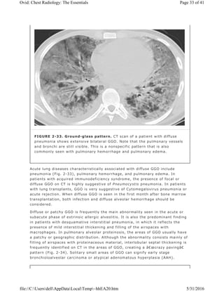 Acute lung diseases characteristically associated with diffuse GGO include
pneumonia (Fig. 2-33), pulmonary hemorrhage, and pulmonary edema. In
patients with acquired immunodeficiency syndrome, the presence of focal or
diffuse GGO on CT is highly suggestive of Pneumocystis pneumonia. In patients
with lung transplants, GGO is very suggestive of Cytomegalovirus pneumonia or
acute rejection. When diffuse GGO is seen in the first month after bone marrow
transplantation, both infection and diffuse alveolar hemorrhage should be
considered.
Diffuse or patchy GGO is frequently the main abnormality seen in the acute or
subacute phase of extrinsic allergic alveolitis. It is also the predominant finding
in patients with desquamative interstitial pneumonia, in which it reflects the
presence of mild interstitial thickening and filling of the airspaces with
macrophages. In pulmonary alveolar proteinosis, the areas of GGO usually have
a patchy or geographic distribution. Although the abnormality consists mainly of
filling of airspaces with proteinaceous material, interlobular septal thickening is
frequently identified on CT in the areas of GGO, creating a â€œcrazy pavingâ€
pattern (Fig. 2-34). Solitary small areas of GGO can signify early stage
bronchioloalveolar carcinoma or atypical adenomatous hyperplasia (AAH).
FIGURE 2-33. Ground-glass pattern. CT scan of a patient with diffuse
pneumonia shows extensive bilateral GGO. Note that the pulmonary vessels
and bronchi are still visible. This is a nonspecific pattern that is also
commonly seen with pulmonary hemorrhage and pulmonary edema.
Page 33 of 41Ovid: Chest Radiology: The Essentials
5/31/2016file://C:UsersdellAppDataLocalTemp~hhEA20.htm
 