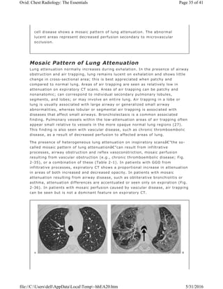 Mosaic Pattern of Lung Attenuation
Lung attenuation normally increases during exhalation. In the presence of airway
obstruction and air trapping, lung remains lucent on exhalation and shows little
change in cross-sectional area; this is best appreciated when patchy and
compared to normal lung. Areas of air trapping are seen as relatively low in
attenuation on expiratory CT scans. Areas of air trapping can be patchy and
nonanatomic; can correspond to individual secondary pulmonary lobules,
segments, and lobes; or may involve an entire lung. Air trapping in a lobe or
lung is usually associated with large airway or generalized small airway
abnormalities, whereas lobular or segmental air trapping is associated with
diseases that affect small airways. Bronchiolectasis is a common associated
finding. Pulmonary vessels within the low-attenuation areas of air trapping often
appear small relative to vessels in the more opaque normal lung regions (27).
This finding is also seen with vascular disease, such as chronic thromboembolic
disease, as a result of decreased perfusion to affected areas of lung.
The presence of heterogeneous lung attenuation on inspiratory scansâ€”the so-
called mosaic pattern of lung attenuationâ€”can result from infiltrative
processes, airway obstruction and reflex vasoconstriction, mosaic perfusion
resulting from vascular obstruction (e.g., chronic thromboembolic disease; Fig.
2-35), or a combination of these (Table 2-1). In patients with GGO from
infiltrative processes, expiratory CT shows a proportional increase in attenuation
in areas of both increased and decreased opacity. In patients with mosaic
attenuation resulting from airway disease, such as obliterative bronchiolitis or
asthma, attenuation differences are accentuated or seen only on expiration (Fig.
2-36). In patients with mosaic perfusion caused by vascular disease, air trapping
can be seen but is not a dominant feature on expiratory CT.
cell disease shows a mosaic pattern of lung attenuation. The abnormal
lucent areas represent decreased perfusion secondary to microvascular
occlusion.
Page 35 of 41Ovid: Chest Radiology: The Essentials
5/31/2016file://C:UsersdellAppDataLocalTemp~hhEA20.htm
 