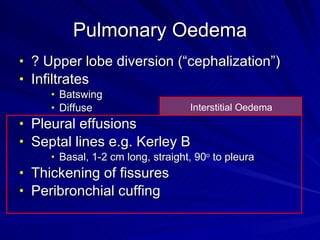 Chest radiology in intensive care | PPT