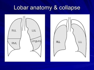 Chest radiology in intensive care | PPT