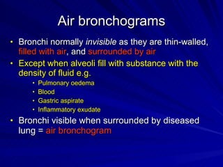 Chest radiology in intensive care | PPT