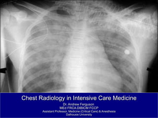 Chest Radiology in Intensive Care Medicine Dr. Andrew Ferguson  MEd FRCA DIBICM FCCP Assistant Professor, Medicine (Critical Care) & Anesthesia Dalhousie University 