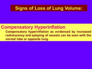 Chest radiology part 2 | PDF