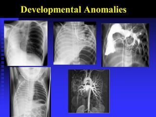 Developmental Anomalies
 