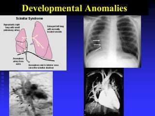 Developmental Anomalies
 