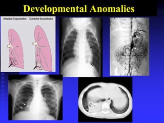 Developmental Anomalies
 