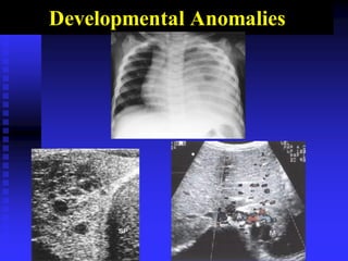 Developmental Anomalies
 