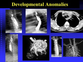 Developmental Anomalies
 