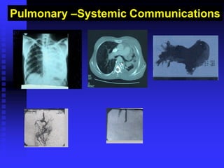 Pulmonary –Systemic Communications
 