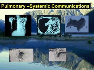 Pulmonary –Systemic Communications
 